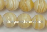 CCA206 15.5 inches 18mm round yellow lace calcite beads
