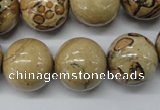 CLD51 15.5 inches 18mm round African leopard skin jasper beads