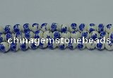 CPB545 15.5 inches 14mm round Painted porcelain beads