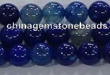 CAA1062 15.5 inches 8mm round dragon veins agate beads wholesale