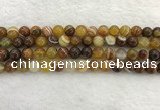 CAA1862 15.5 inches 8mm round banded agate gemstone beads