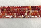 CAA1911 15.5 inches 6mm round banded agate gemstone beads