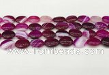 CAA4655 15.5 inches 12*16mm oval banded agate beads wholesale