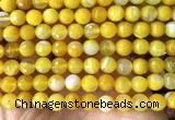 CAA6311 15 inches 8mm faceted round yellow banded agate beads