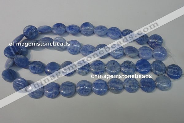 CAG4381 15.5 inches 18mm flat round dyed blue lace agate beads