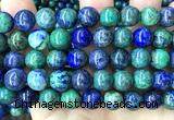 CAZ48 15 inches 10mm round azurite malachite beads wholesale