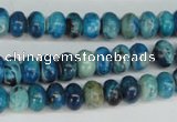 CCO170 15.5 inches 5*8mm rondelle dyed natural chrysotine beads