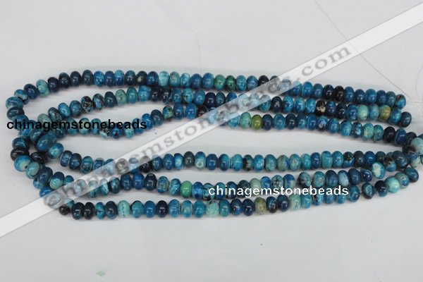 CCO170 15.5 inches 5*8mm rondelle dyed natural chrysotine beads