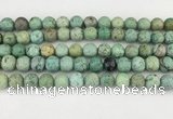 CCO370 15.5 inches 9mm round chrysotine gemstone beads wholesale