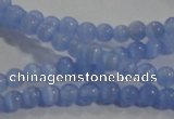 CCT1118 15 inches 2mm round tiny cats eye beads wholesale
