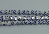 CPB502 15.5 inches 8mm round Painted porcelain beads