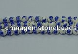 CPB542 15.5 inches 8mm round Painted porcelain beads