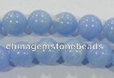CTU1736 15.5 inches 14mm round synthetic turquoise beads