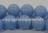 CTU1738 15.5 inches 18mm round synthetic turquoise beads